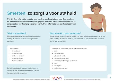 Geen herziening, wel implementatie richtlijn smetten nodig.